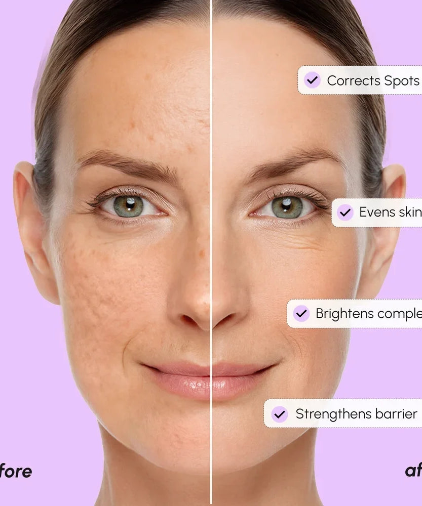 Dark Spot Corrector